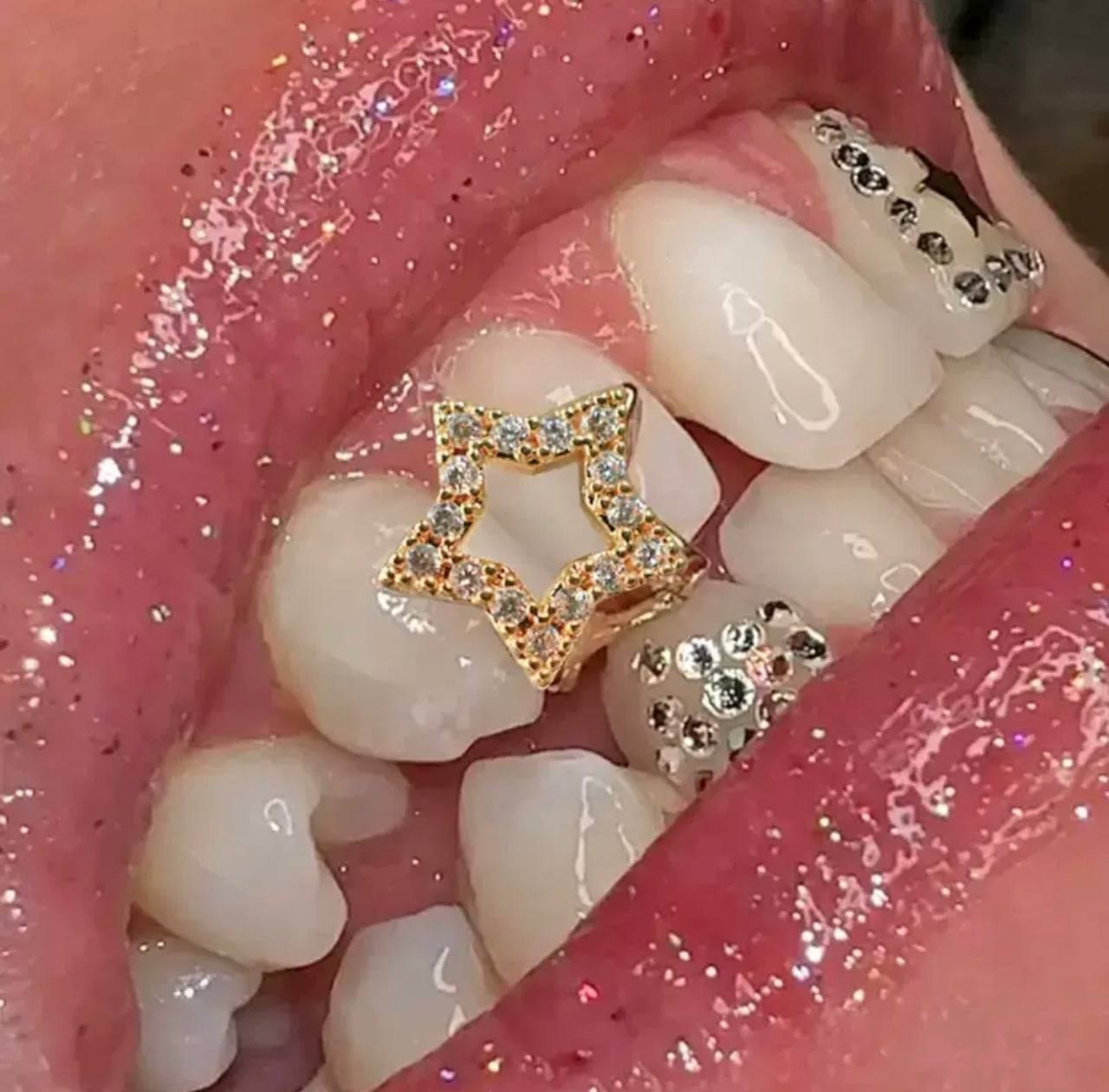 گریلز دندون طرح ستاره نگینی ⭐️💎